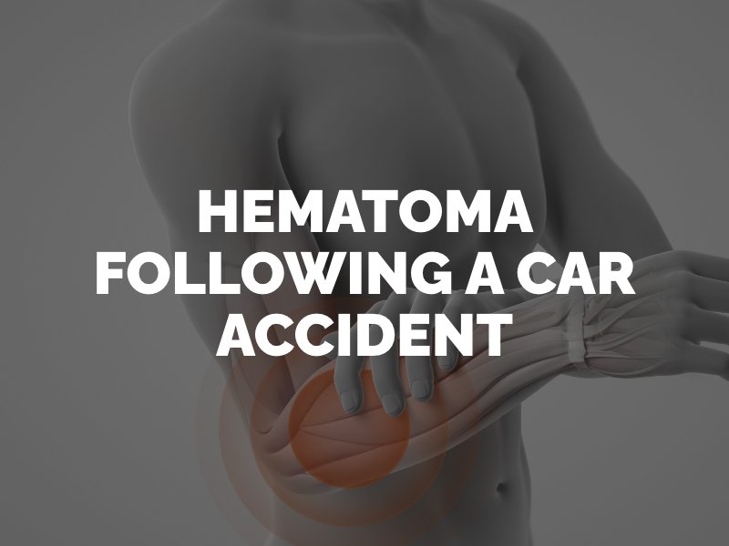 Hematoma after a car accident