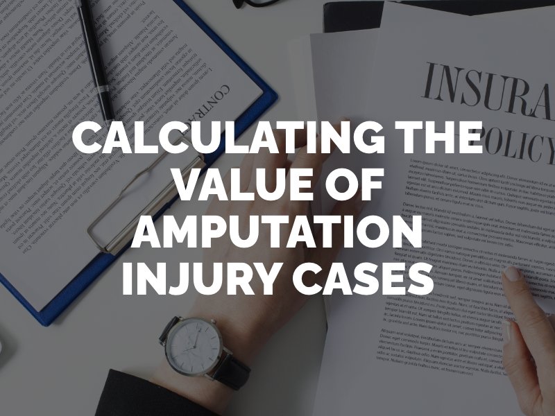 calculating the value of amputation injury cases