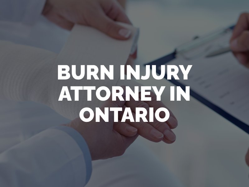 burn injury attorney in Ontario