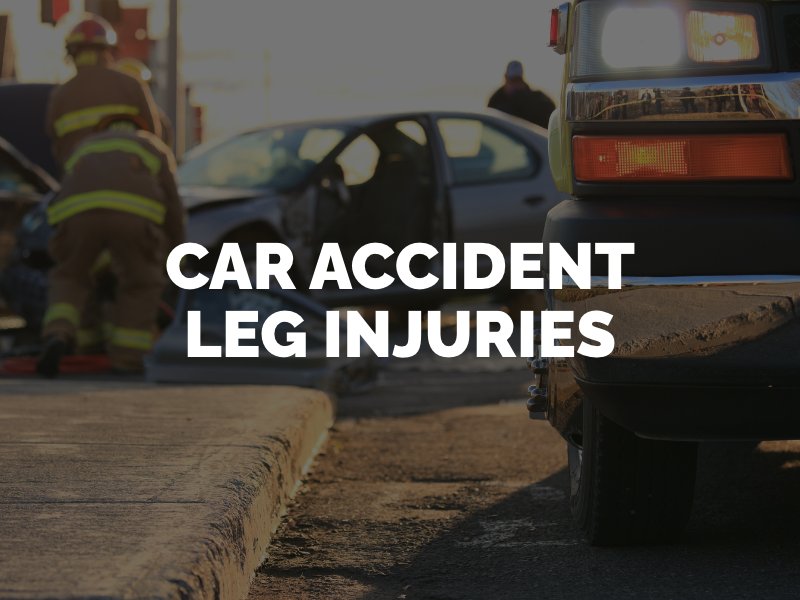 car accident leg injuries