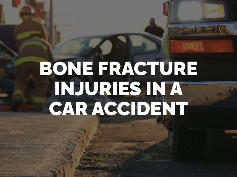 bone fracture injuries in a car accident